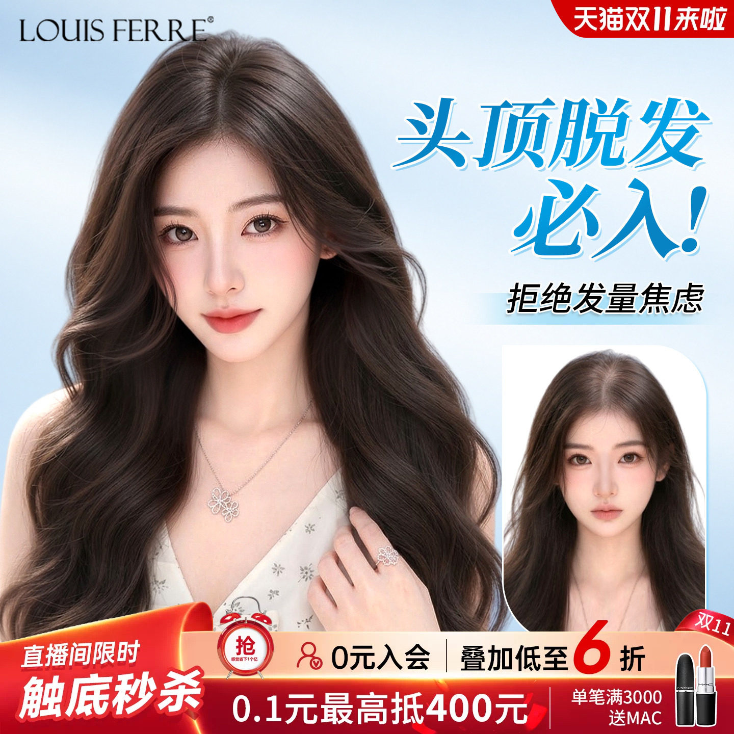 头顶脱发必入免发网假发片女全真人发遮白发长卷发补发片蓬松无痕
