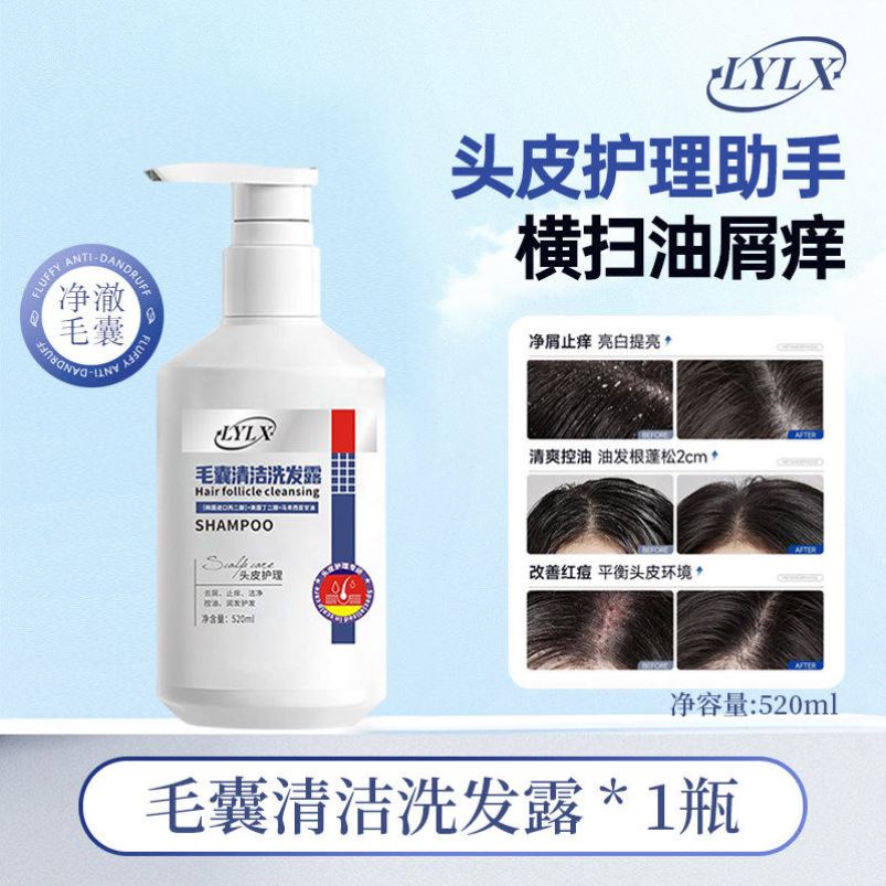 去屑洗发水毛囊控油止痒头皮清洁蓬松炎头膏男女官方正品牌洗发露