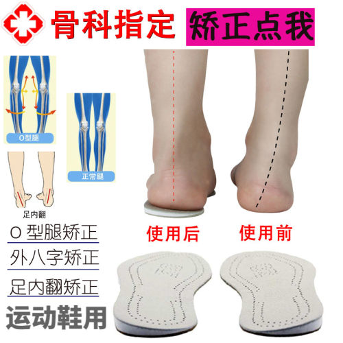 O型腿矫正鞋垫翻外双面牛皮
