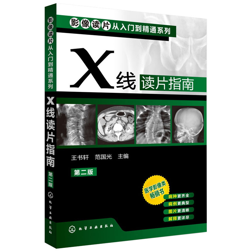 XÏß¶ÁƬָÄÏ(µÚ¶þ°æ) Ó°ÏñѧҽѧÀàÊé Ó°Ïñ½âÆÊѧÕï¶ÏͼÆ× Ó°Ïñ¶ÁƬ´ÓÈëÃŵ½¾«Í¨ÏµÁÐ(µÚ¶þ°æ)