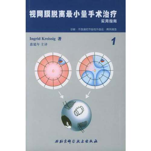 正版图书丨 视网膜脱离最小量手术治疗实用指南  （德）Ingrid Kreissig著；惠延年主译 9787530428740