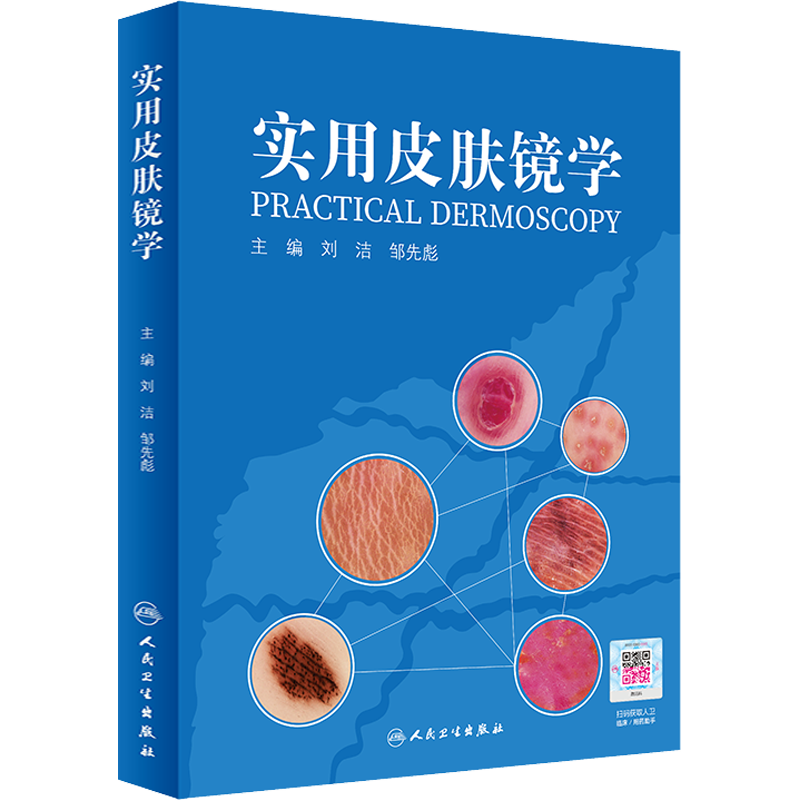 实用皮肤镜学 刘洁,邹先彪 编 皮肤病学/性病学生活 新华书店正版图书籍 人民卫生出版社