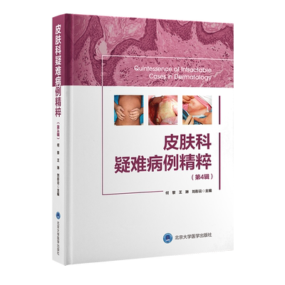 皮肤科疑难病例精粹(第4辑) 何黎,王琳,刘彤云 编 皮肤病学/性病学生活 新华书店正版图书籍 北京大学医学出版社
