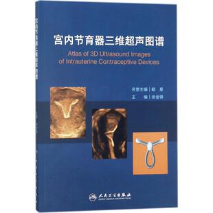 宫内节育器三维超声图谱 徐金锋 主编 妇产科学生活 新华书店正版图书籍 人民卫生出版社
