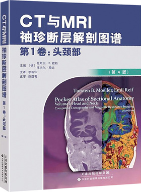 CT与MRI袖珍断层解剖图谱.第1卷,头颈部第1卷,头颈部