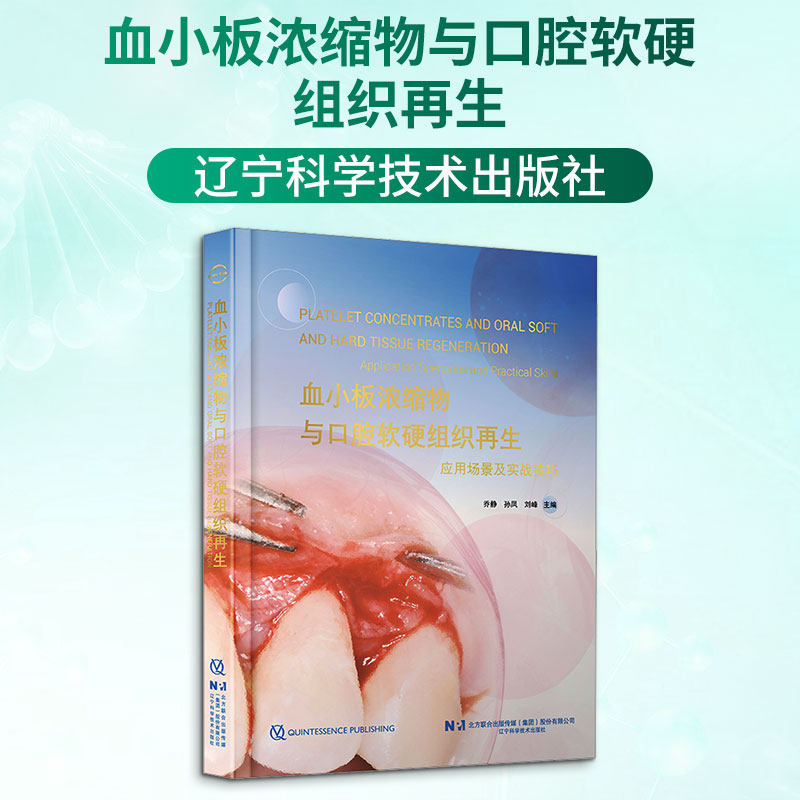 血小板浓缩物与口腔软硬组织再生 乔静,孙凤,刘峰 主编 编 内科学生活 新华书店正版图书籍 辽宁科学技术出版社