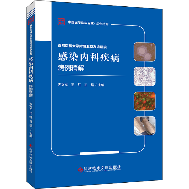 首都医科大学附属北京友谊医院感染内科疾病病例精解 齐文杰,王红,王超 编 临床医学生活 新华书店正版图书籍 科学技术文献出版社