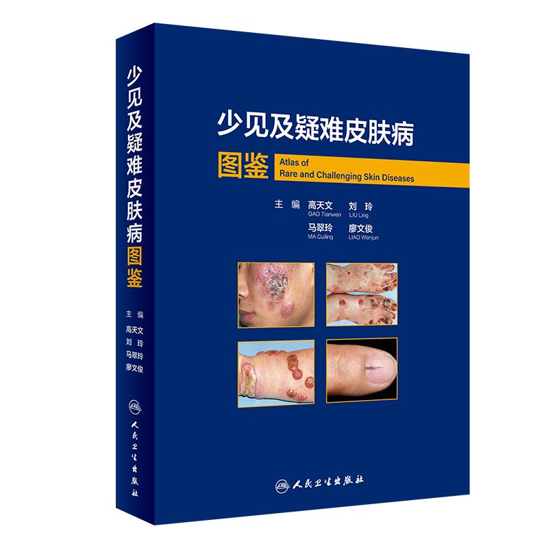 少见及疑难皮肤病图鉴 高天文 等 编 皮肤病学/性病学生活 新华书店正版图书籍 人民卫生出版社