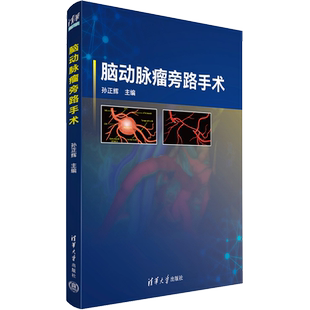 脑动脉瘤旁路手术 孙正辉 编 肿瘤学生活 新华书店正版图书籍 清华大学出版社