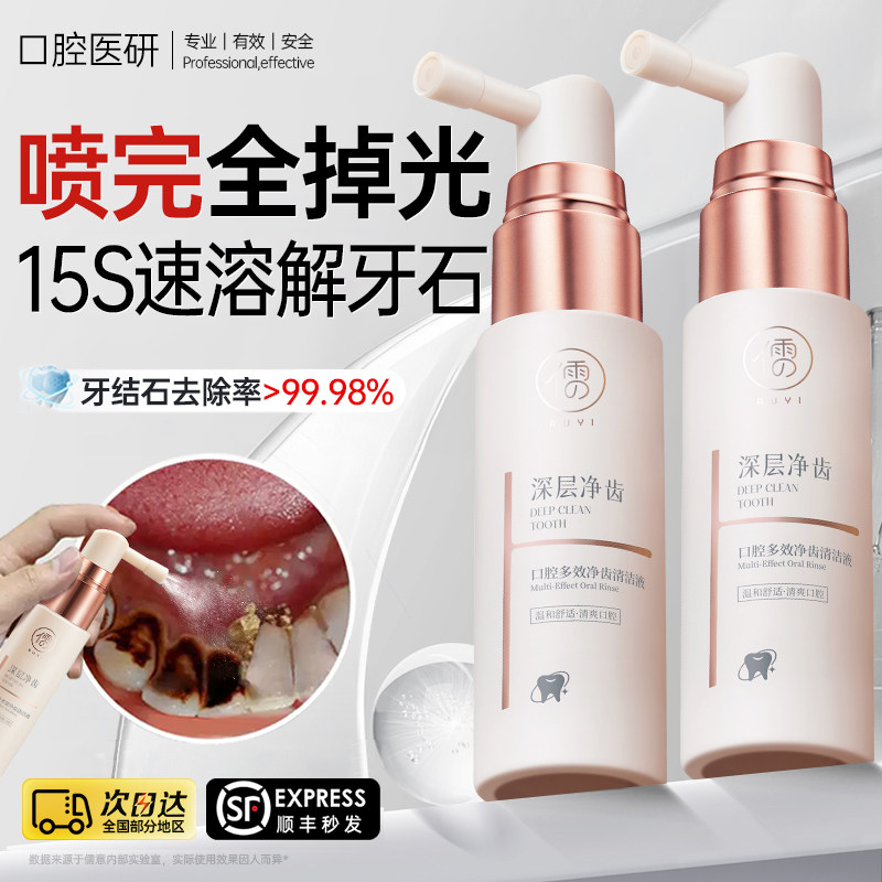 牙结石去除器医溶解用除速效漱口水洗牙齿污垢牙黄垢牙渍清理神器