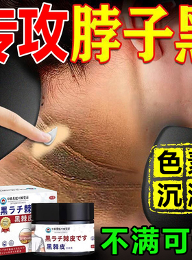 去脖子黑色素去除黑脖子棘皮黑色素沉淀洗不干净白肥胖儿童美神器