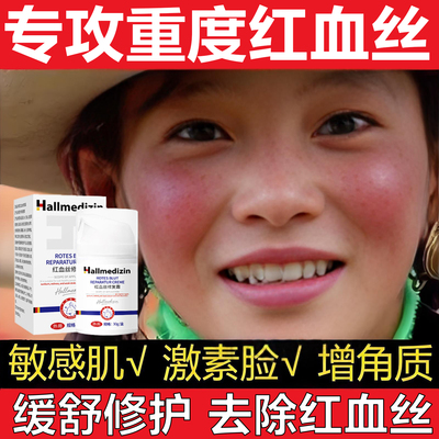 去红血丝增厚角质层受损修护面霜修红改善面部泛红脸修复皮肤屏障