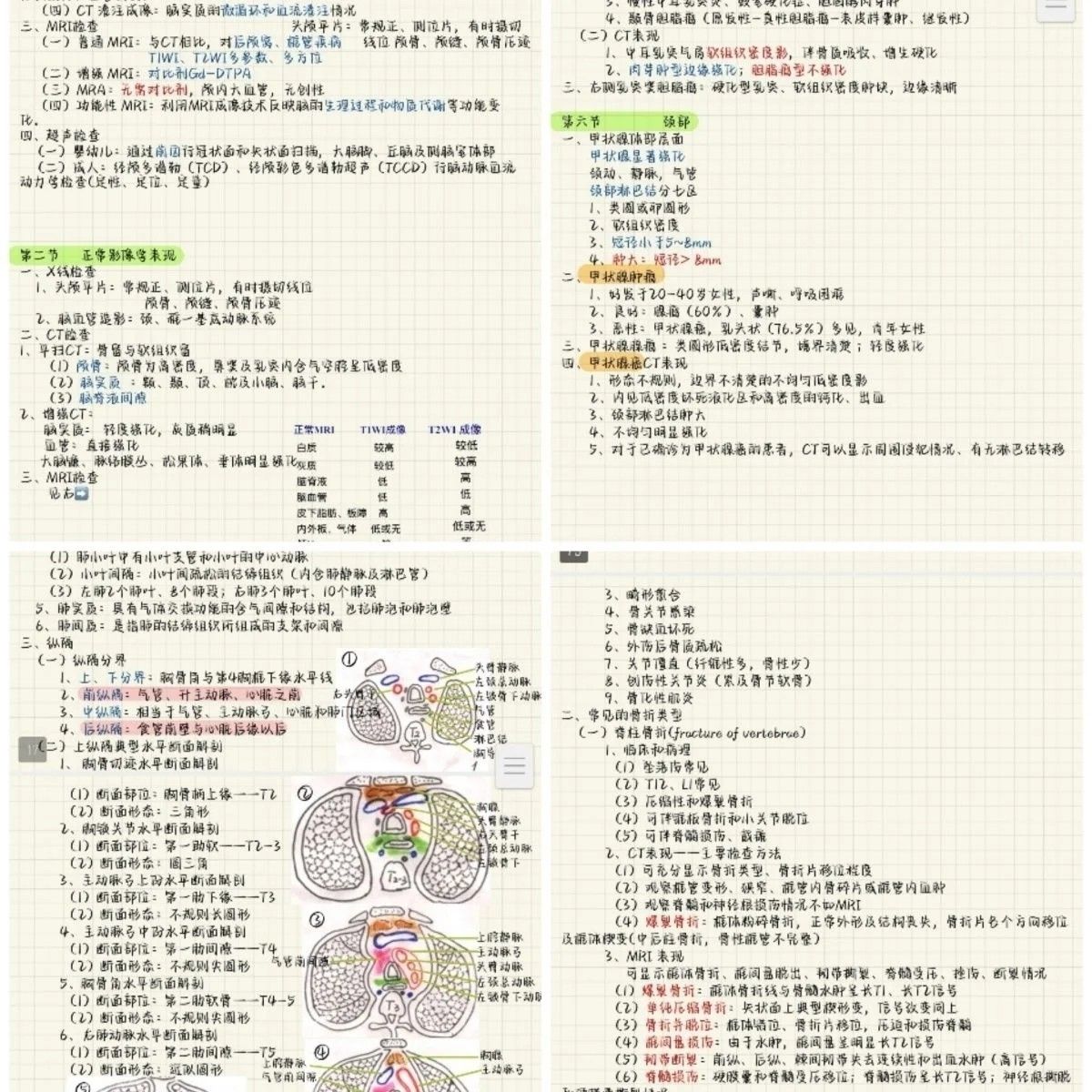 医学影像学笔记影像学视频神经影像脑影像阅片资料
