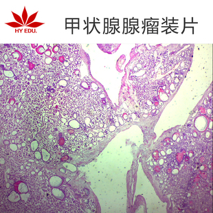 【红叶】甲状腺腺瘤切片高教病理类组织标本生物标本成像清晰