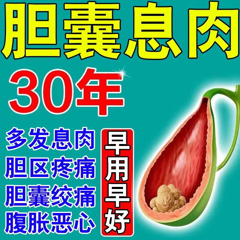 胆结石溶石化石排石胆囊息肉胆康专用特効调理鸡内金胆结石膏贴wl