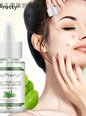 joypretty茶树痘痘修护 爽肤水 收细毛孔保湿原液淡化痘坑 精华液