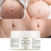 Stretch Mark Cream肥胖身体纹护理霜紧致滋养淡化产后孕纹修护霜