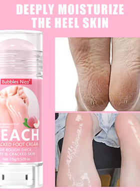 Foot Cream Stick Foot Skin Care Dry Irritated Moisturizer