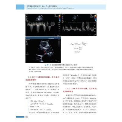 经导管主动脉瓣植入术 原著 (意) Arturo Giordano, Giuseppe Biondi-Zoccai, Giacomo Frati 9787504695222