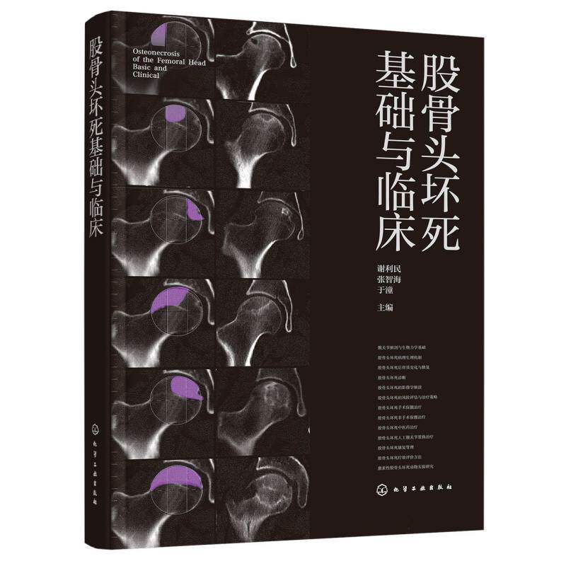 股骨头坏死基础与临床 谢利民, 张智海, 于潼主编 9787122475930