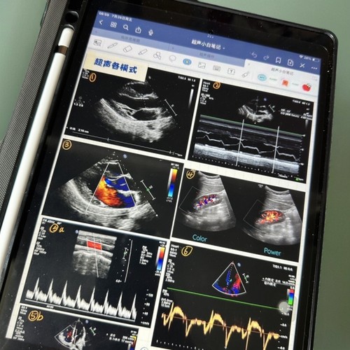 超声笔记医学超声诊断规培结业考手写超声笔记A4铜版纸复印纸打印