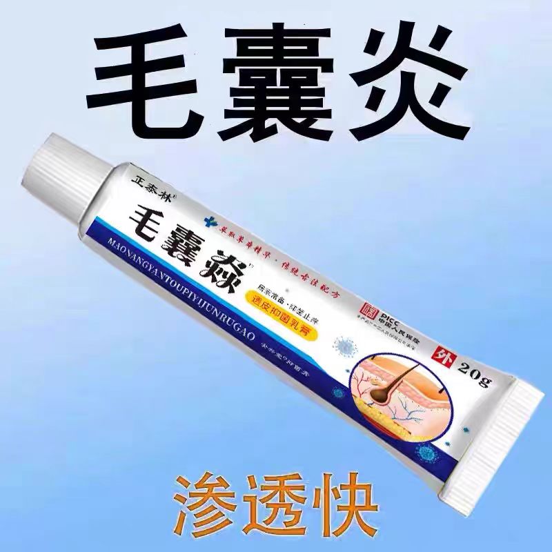 头皮毛囊炎头部头痒有红疙瘩专用长痘痘去手臂后背马拉色菌乳膏