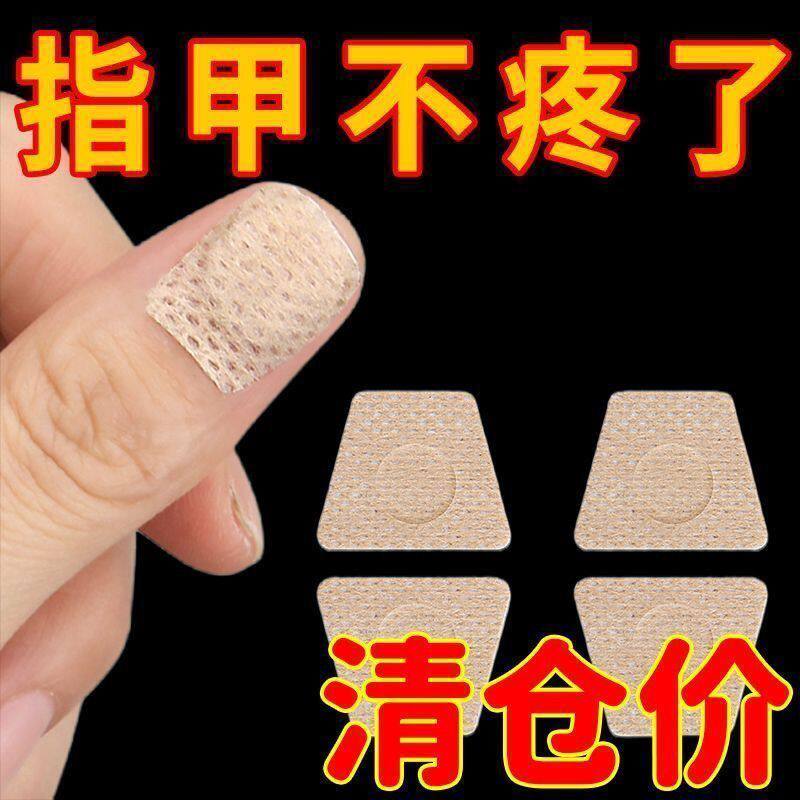 灰指甲嵌甲甲沟往肉里长大拇指头矫形贴软甲护理神器
