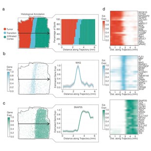 生信分析服务|医学公共数据挖掘 | 热图/火山图 | 适合临床科研