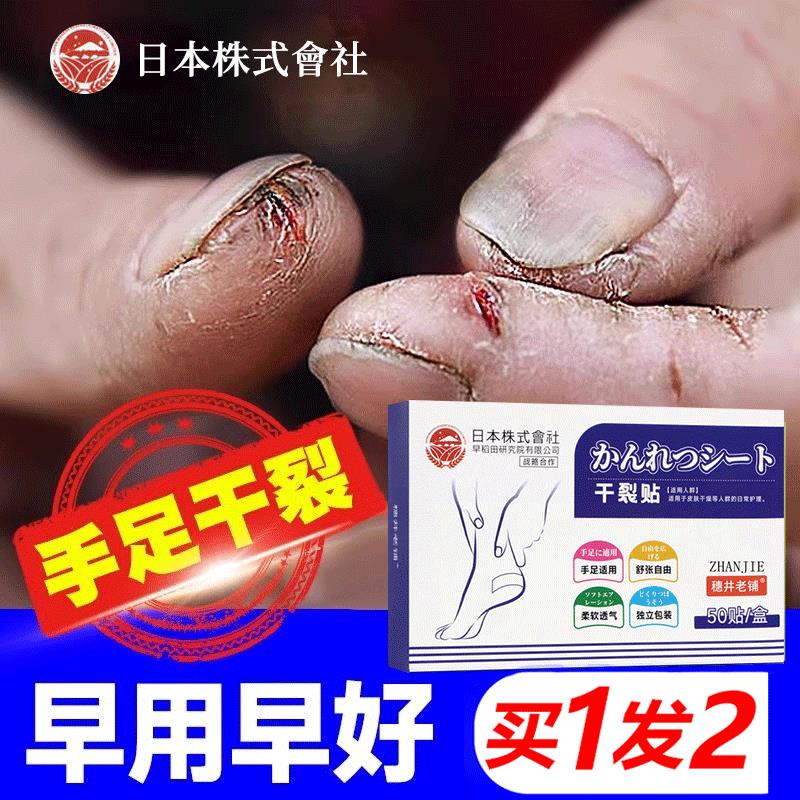 日本正品手脚干裂贴手足专用胶布护手指防裂口皲裂卫仕卷手部脚跟