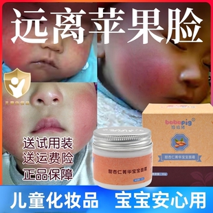波波猪婴儿童宝宝 补水皲擦苹果红脸春夏秋冬皴润肤裂 面霜滋保湿