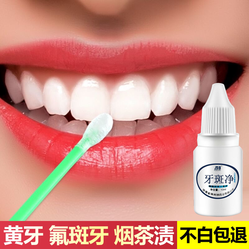 牙斑净 黄牙烟牙黑渍牙垢洗牙粉液牙贴膏白牙素