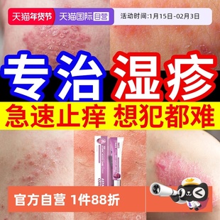 【自营】湿疹膏根湿疹止痒去外用顽固皮炎神经性汗疱疹除湿止痒膏