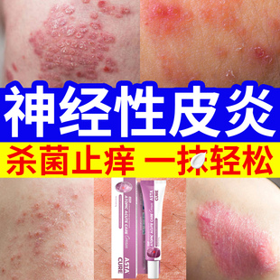 【自营】神经性皮炎湿疹药膏止痒去根特效药皮肤瘙痒外用顽固皮炎