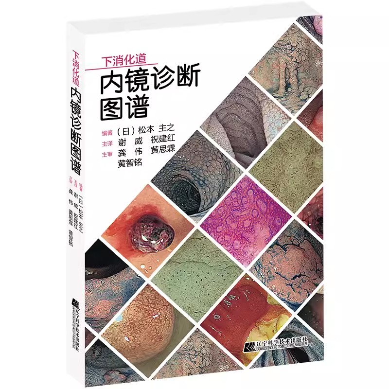 下消化道内镜诊断图谱 谢威 祝建红 译 消化道内镜操作注意事项中初级内镜医生参考书外科 辽宁科学技术出版社9787559123510
