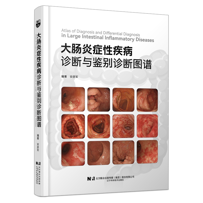 正版包邮 大肠炎症性疾病诊断与鉴别诊断图谱 安彦军 临床医学消化科常见疾病诊断治疗教程书籍 肠胃疾病内镜操作技巧大全fx
