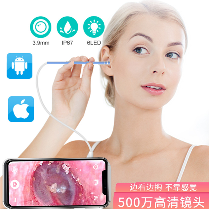 可视神器检查高清摄像头掏耳朵
