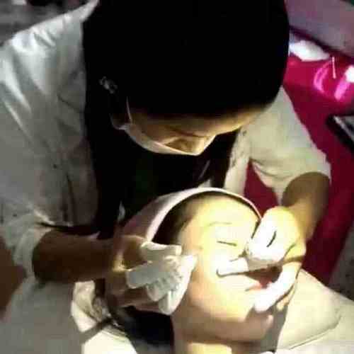 无痛点斑水 这个贵老顾客拍其它需求