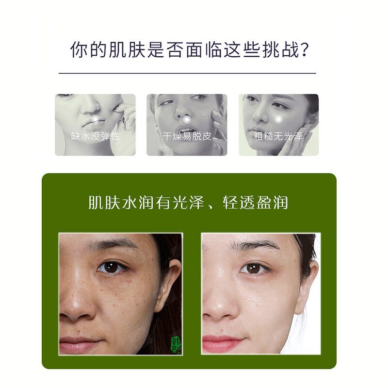 芦荟水乳套装护肤品女补水保湿植物萃取韩茗化妆品正品代发