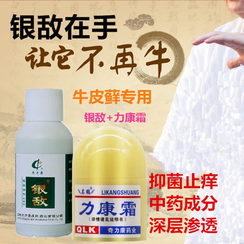 牛皮问题专用套餐奇力康银敌搽剂1瓶+力康霜牛皮银消皮肤抑菌包邮