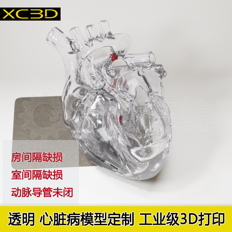 心脏病透明模型房间隔缺损室间隔缺损动脉导管未闭3d打印医学定制