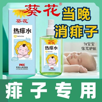 【痱子專用】葵花兒童成人痱子水