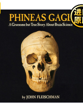 Phineas Gage 菲尼斯盖奇  一个关于脑科学的可怕但真实的故事
