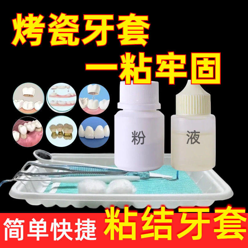 粘烤瓷牙强力专用胶水牙冠脱落假牙连桥瓷牙金属钢牙套脱落粘接剂