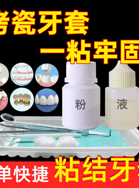 粘烤瓷牙强力专用胶水牙冠脱落假牙连桥瓷牙金属钢牙套脱落粘接剂