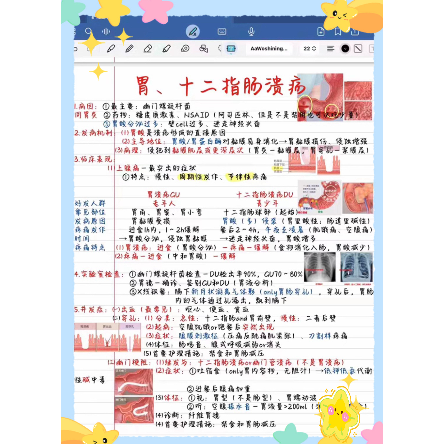 308护综笔记护理综合考研图文笔记内外科护理重点疾病详解PDF版