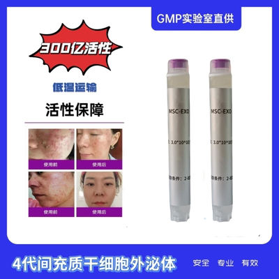 纯外泌体间充质细胞外泌体
