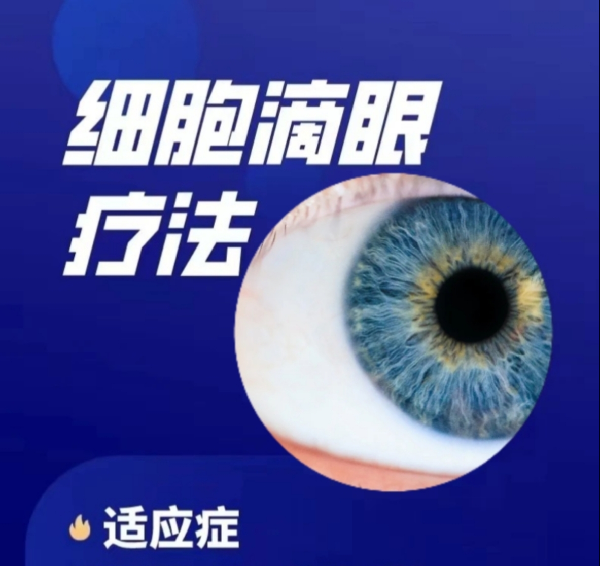 细胞外泌体滴眼液外泌体眼用修复