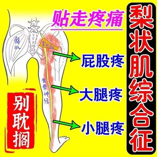 腰椎坐骨贴压迫神经引起屁股大小腿膝盖疼放射性疼痛麻木专用膏贴