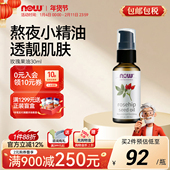 NOWFoods玫瑰果油30ml精华油面部保湿 滋润护肤身体护理焕亮诺奥