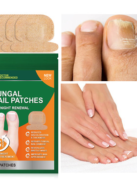 跨境热卖Toenail Fungus Treatment Extra Strength 指甲护理贴